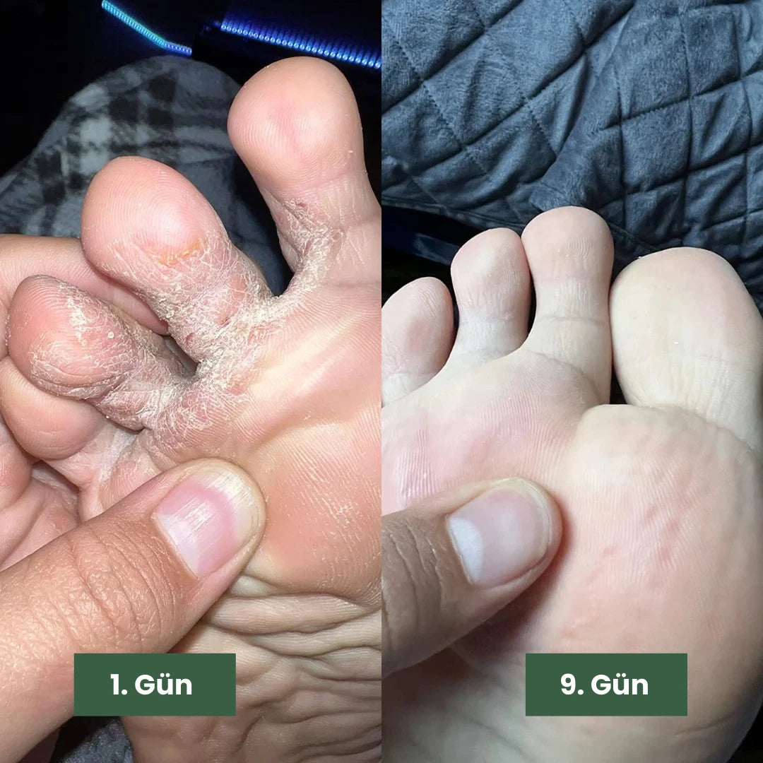 Norevey Yoğun Arındırıcı Çay Ağacı Yağı Bakım Sabunu