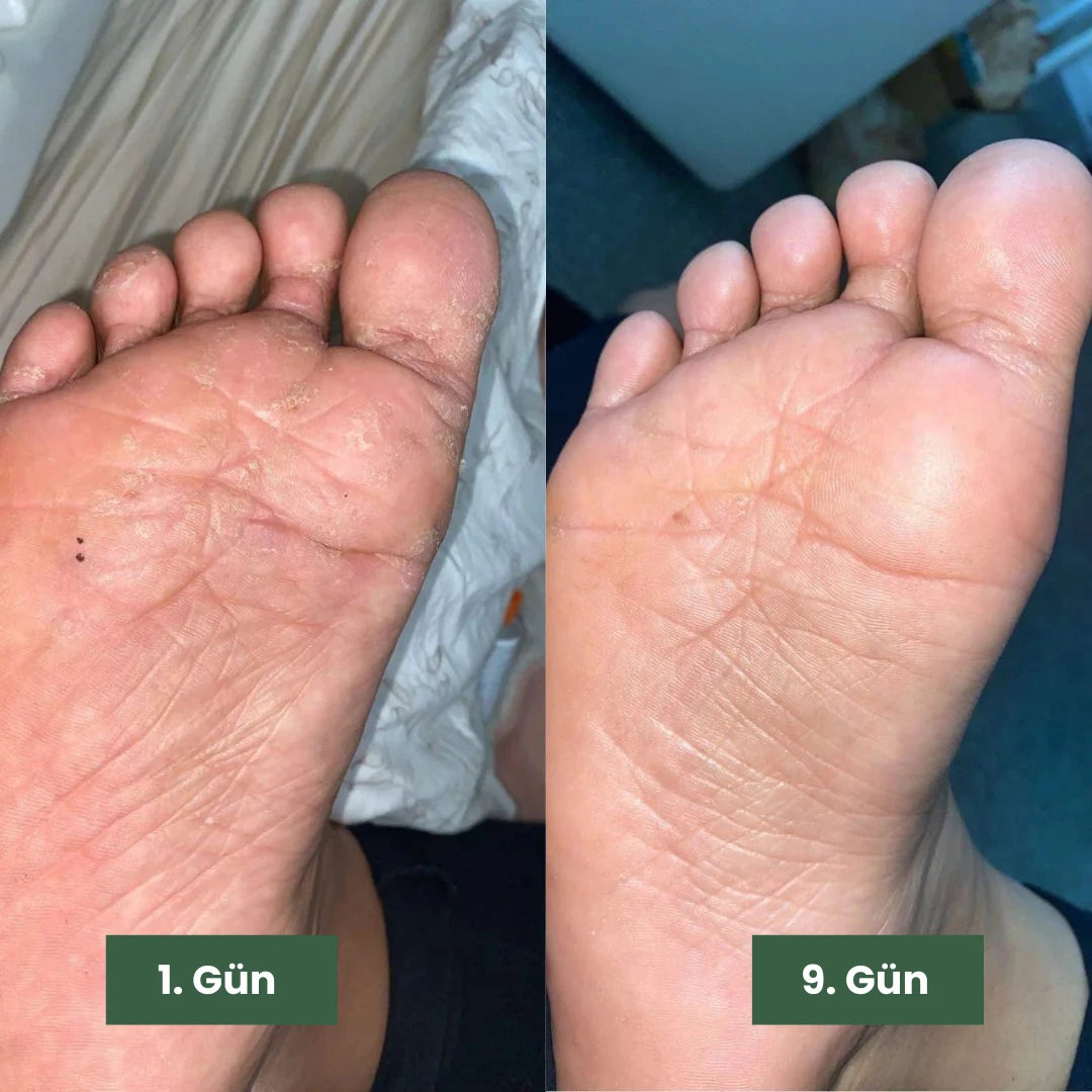 Norevey Yoğun Arındırıcı Çay Ağacı Yağı Bakım Sabunu
